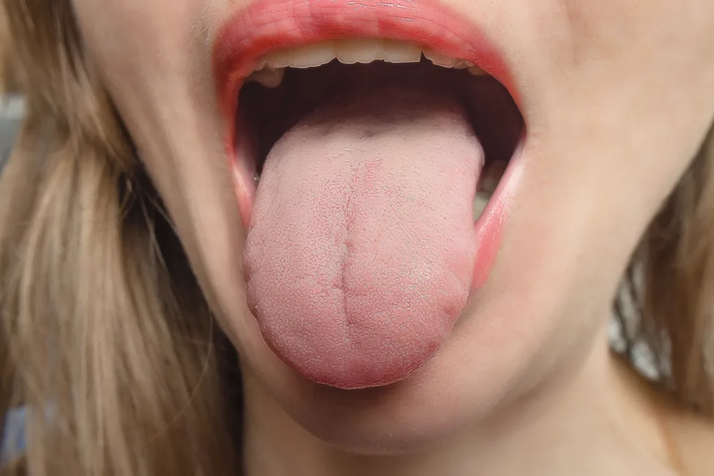 what should your tongue look like