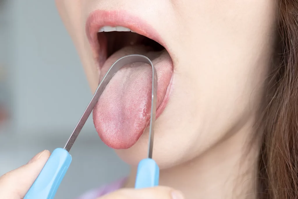 what are the benefits of scraping your tongue