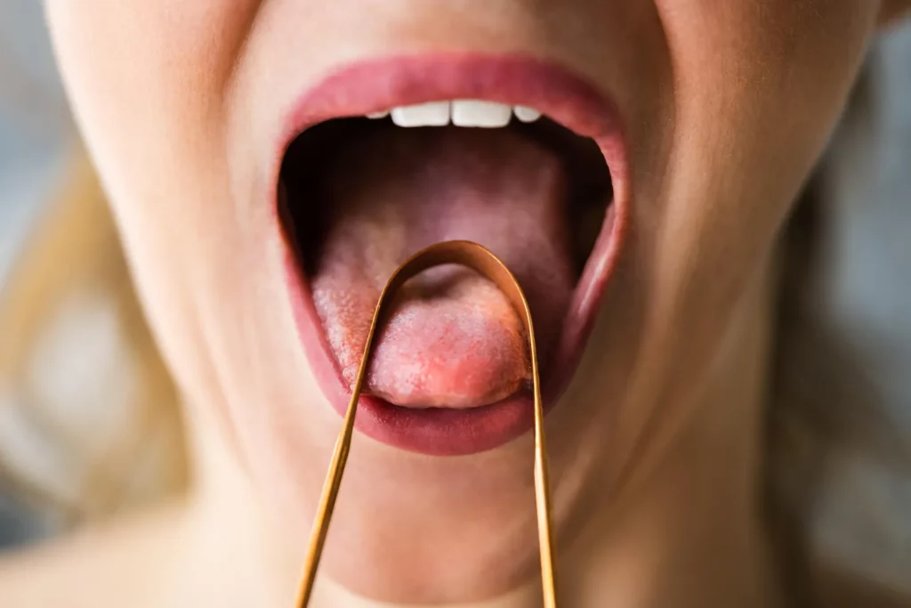 what is tongue scraping