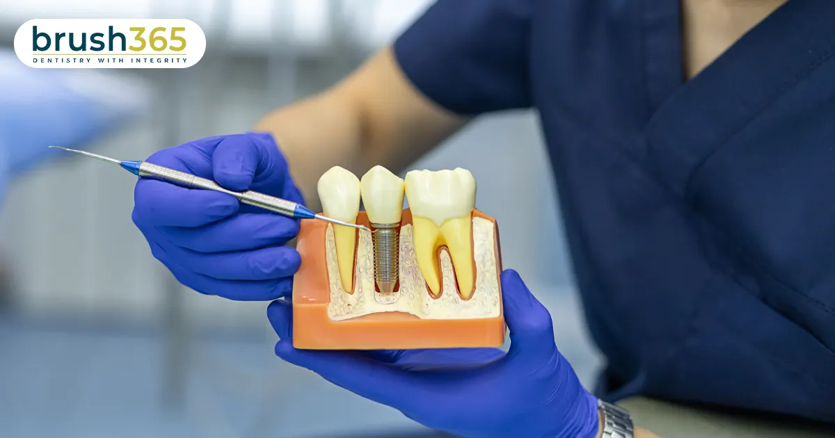 dental implants what you should know