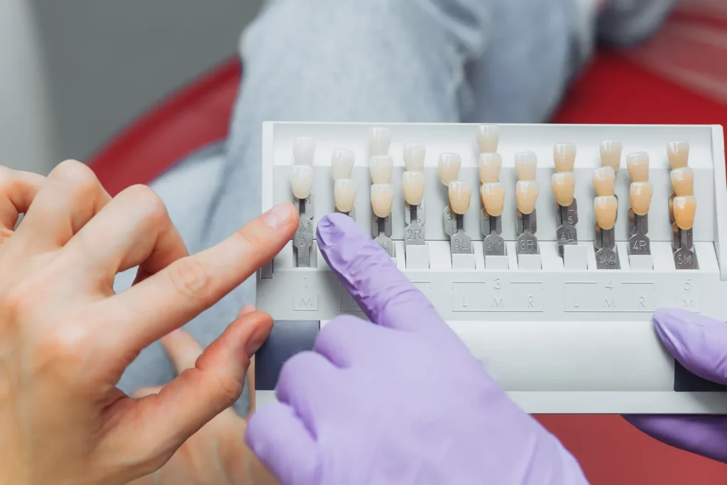 types of dental implants