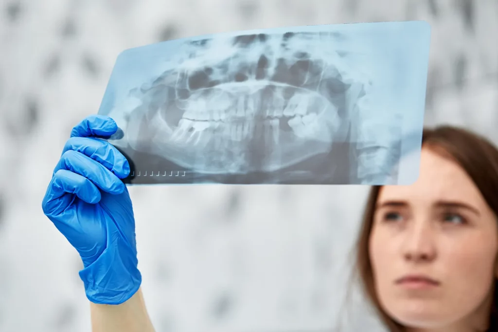 what is jaw bone loss