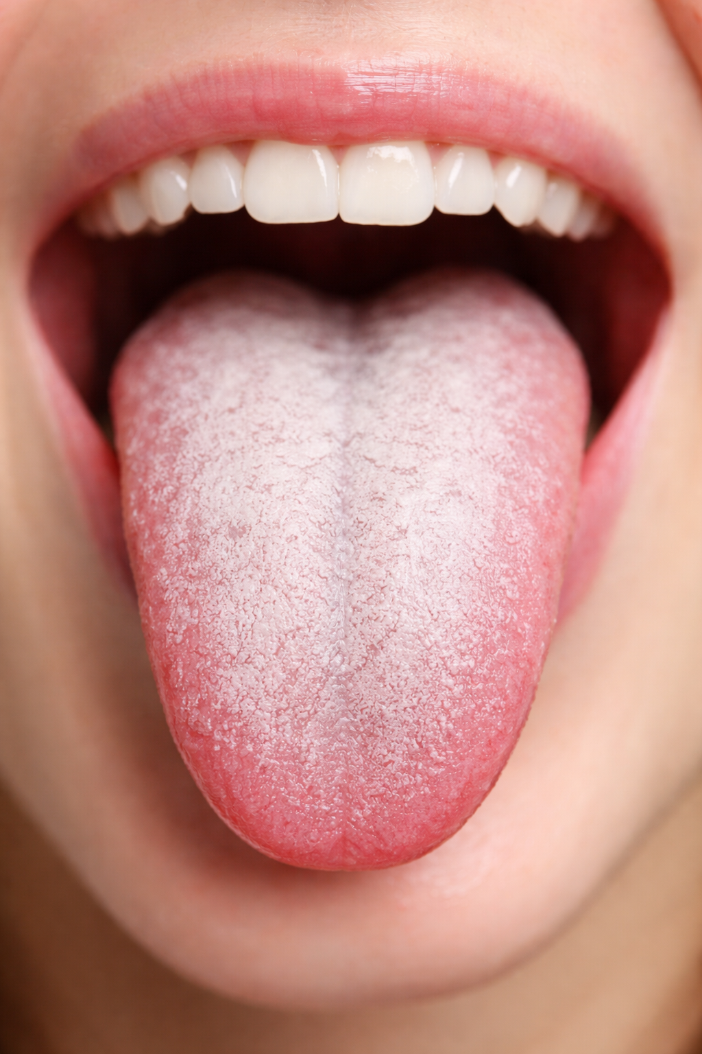 white tongue