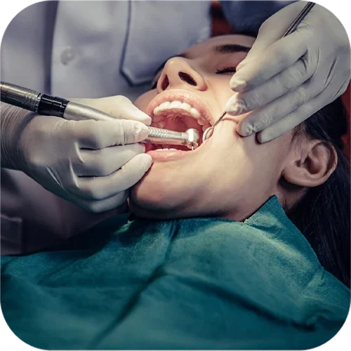 root-canal-treatments